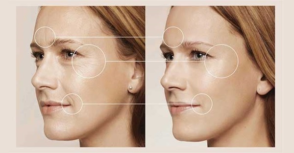 tần số vô tuyến tần số vô tuyến